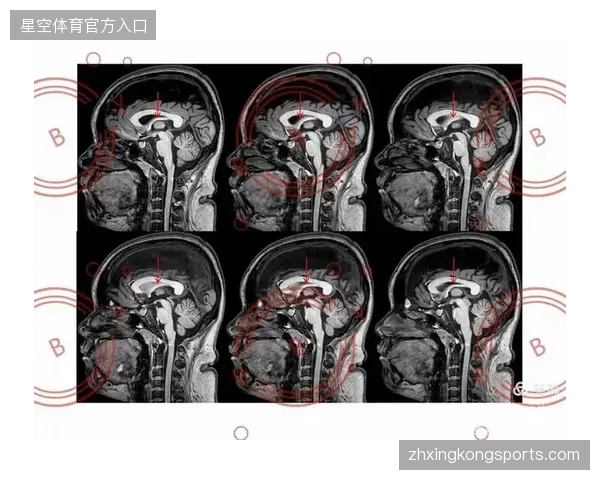 计算资源向赛事举办地边缘侧延伸以降低云转播断层风险 计算资源向赛事举办地边缘侧延伸以降低云转播断层风险